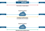 Sự khác biệt giữa AV truyền thống và AV qua IP